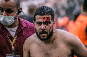 Torcedor sai machucado do jogo entre Corinthians e Grmio na Neo Qumica Arena