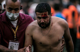 Torcedor sai machucado do jogo entre Corinthians e Grmio na Neo Qumica Arena