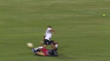 Fessin fraturou a perna em jogo contra o Ituano na Copinha