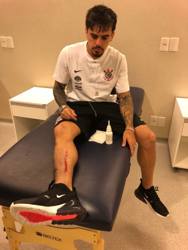 Fagner ficou com corte brutal na perna após jogo contra Mirassol